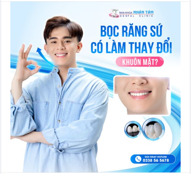 Bọc răng sứ có làm thay đổi khuôn mặt?