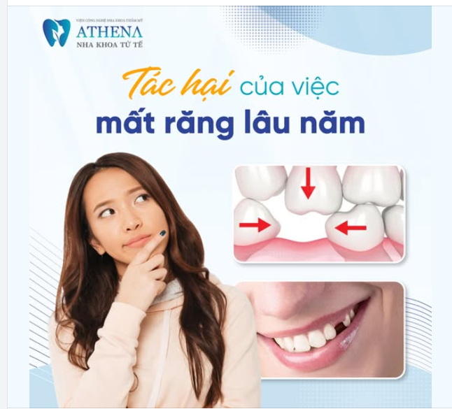 Tác hại khôn lường của việc mất răng