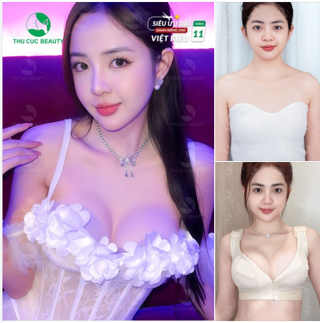 Tùy chọn size và túi ngực phù hợp với hình dáng cơ thể  7 ngày ngực vào form, đẹp tự nhiên