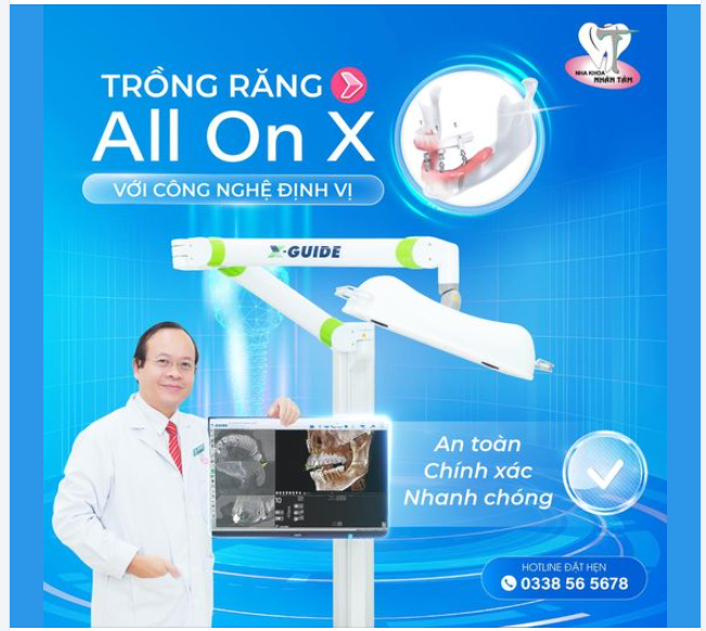 Trồng răng Implant All On X với công nghệ định vị  An toàn - Chính xác - Nhanh chóng