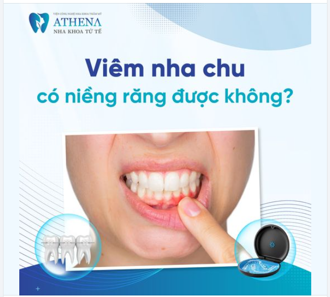 Viêm nha chu là 1 bệnh lý về nướu, làm tổn thương các mô xung quanh răng.