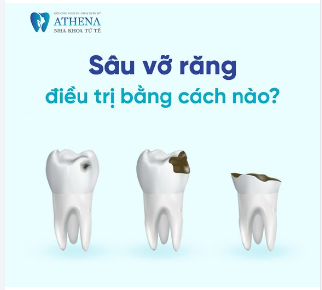 Sâu răng bị vỡ phải điều trị như thế nào?
