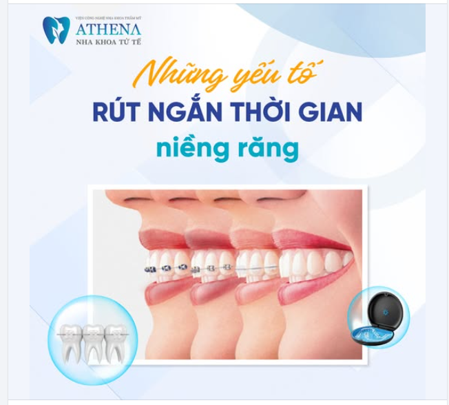 Bí quyết rút ngắn thời gian niềng răng hiệu quả