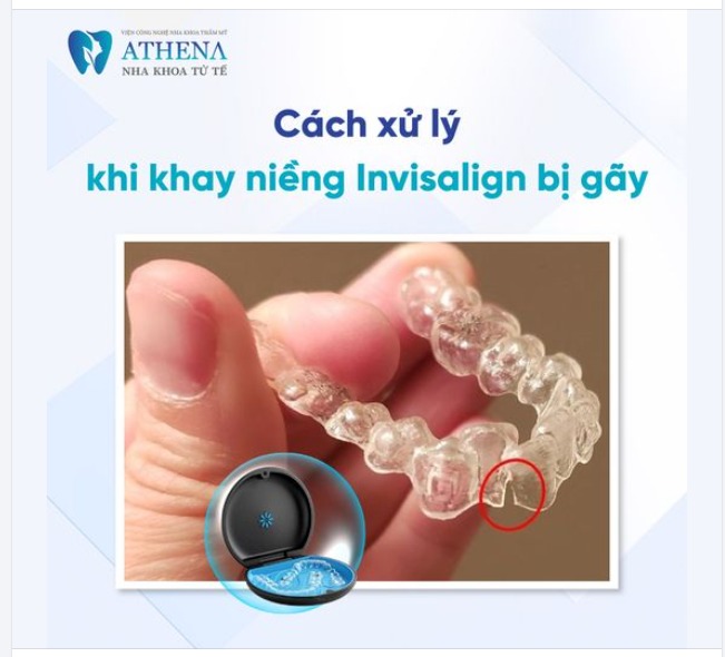 Cách xử lý khay Niềng răng Invisalign bị gãy