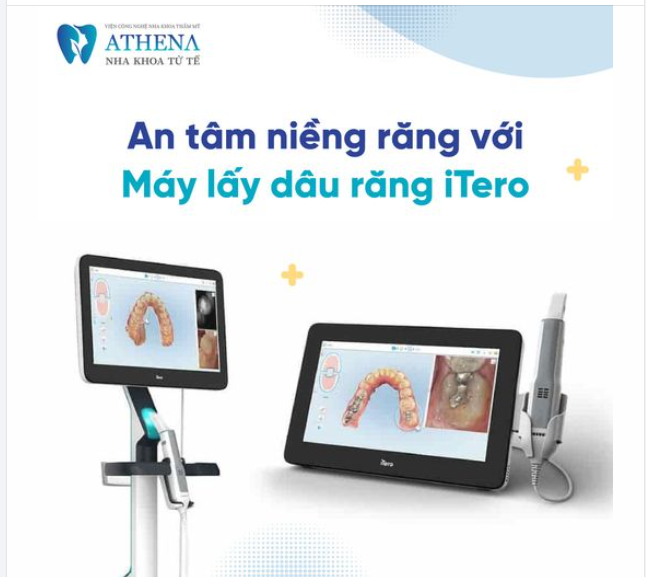 Máy scan iTero là công nghệ tiên tiến giúp việc niềng răng trở nên nhanh chóng và chính xác hơn bao giờ hết.