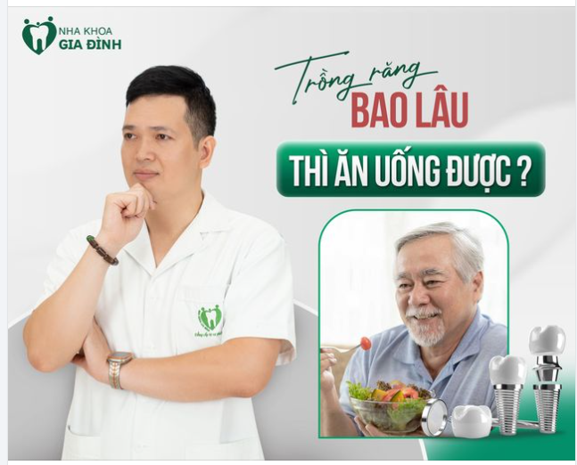 TRỒNG RĂNG BAO LÂU THÌ ĂN UỐNG ĐƯỢC?