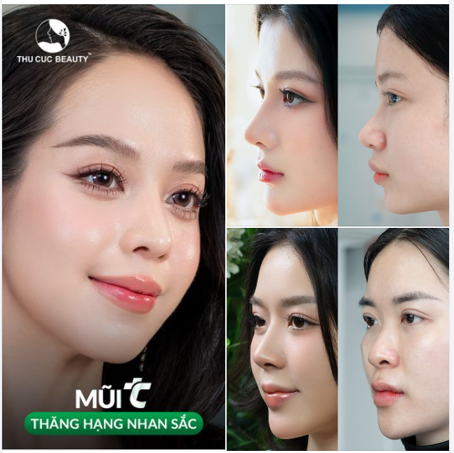 Bệnh viện Thẩm mỹ Thu Cúc  Nơi sắc đẹp khởi nguồn hạnh phúc!