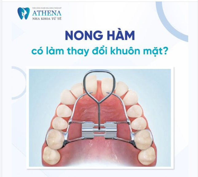 Nong hàm có thể thay đổi gương mặt không?