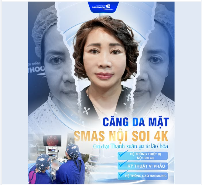 CĂNG DA MẶT SMAS NỘI SOI 4K GIỮ CHẶT THANH XUÂN GIÃ TỪ LÃO HÓA