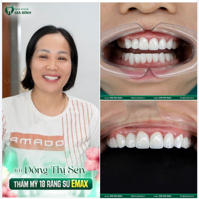 Sáng ra nở một nụ cười  Trong ngày sẽ thấy lắm hoa tươi.