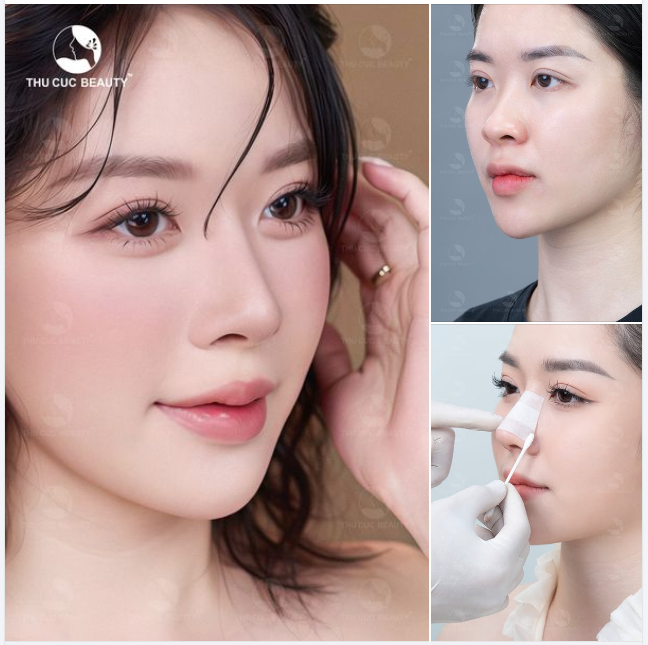 Càng nhìn càng mê với dáng mũi này