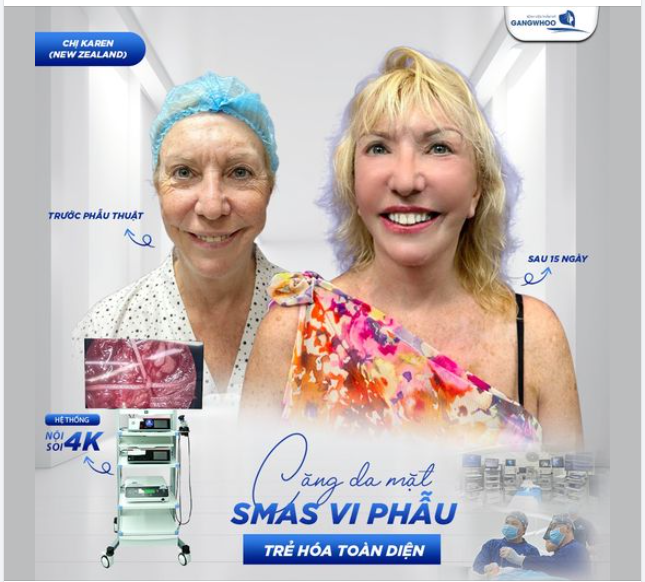 Phương pháp căng da mặt SMAS này đã không còn quá xa lạ với chị em phụ nữ mong muốn có được làn da trẻ trung xinh đẹp.