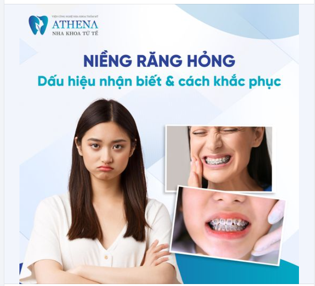 Dấu hiệu nhận biết niềng răng hỏng và cách khắc phục