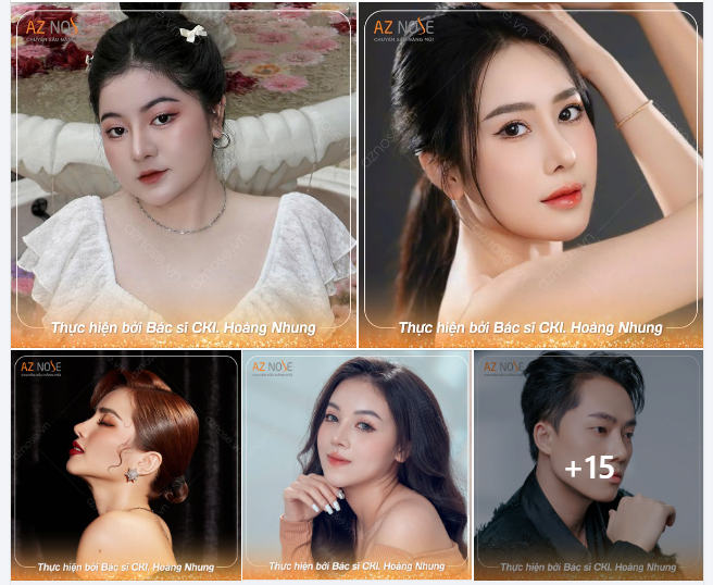 Toả sáng với dáng mũi được kiến tạo bởi bác sĩ CKI. Hoàng Nhung