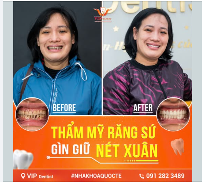 LÀ PHỤ NỮ, KHÔNG AI MONG MUỐN BẢN THÂN MÌNH GIÀ ĐI