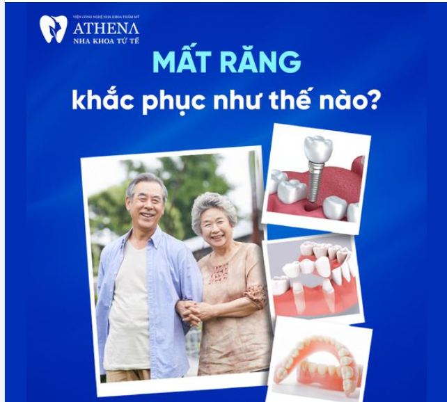 Mất răng : Đâu là giải pháp phục hồi tốt nhất