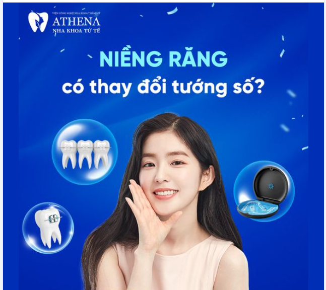 Niềng răng có thay đổi tướng số không?