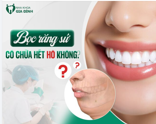 BỌC RĂNG SỨ CÓ CHỮA HẾT HÔ KHÔNG?