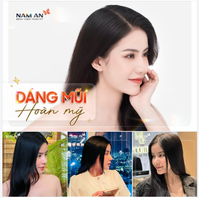 BẠN MUỐN CÓ SỐNG MŨI CAO HÀI HÒA VỚI KHUÔN MẶT