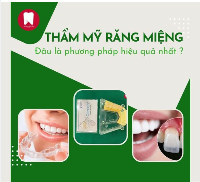 THẨM MỸ RĂNG MIỆNG - ĐÂU LÀ PHƯƠNG PHÁP TOÀN DIỆN, HIỆU QUẢ VÀ AN TOÀN NHẤT