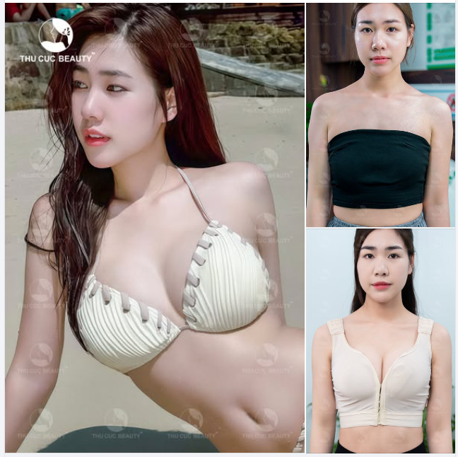 Nâng ngực TC Dáng linh hoạt - Không bao xơ - Thoải mái vận động