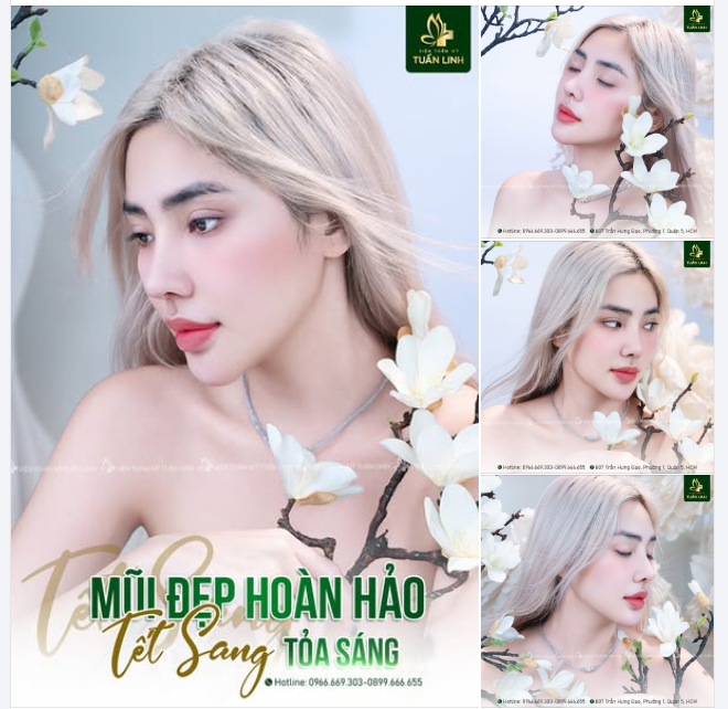 NÂNG MŨI XINH - ĐÓN TẾT SANG!!
