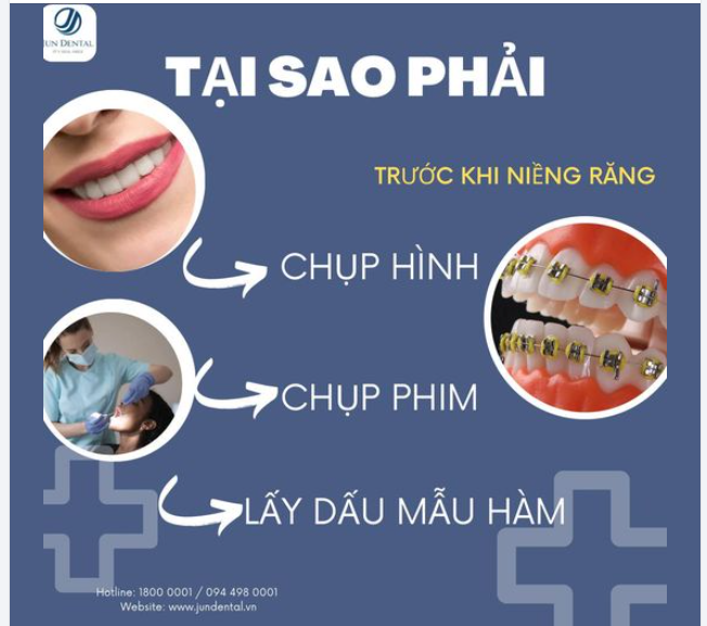 TẠI SAO PHẢI CHỤP HÌNH, CHỤP PHIM, LẤY DẤU MẪU HÀM TRƯỚC KHI NIỀNG RĂNG?