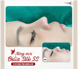 NÂNG MŨI BELLA SILK 5S   Tự tin trong từng khoảng khắc