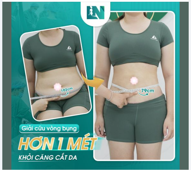 BỤNG TO HƠN 1 MÉT? BIẾN HÓA THON GỌN CHỈ SAU 90 PHÚT!