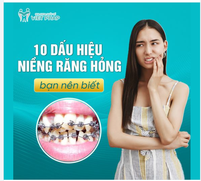 10 DẤU HIỆU NIỀNG RĂNG HỎNG BẠN NÊN BIẾT