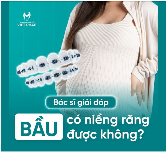 BẦU CÓ NIỀNG RĂNG ĐƯỢC KHÔNG?