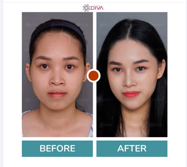 ĐIỀU GÌ TRÊN KHUÔN MẶT CỦA CÔ GÁI ĐƯỢC CẢI THIỆN RÕ RỆT NHẤT?