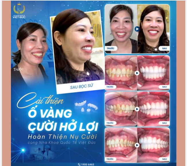HẾT HÔ, HẾT HỞ LỢI – NỤ CƯỜI ĐẸP ĐÁNH THỨC THANH XUÂN