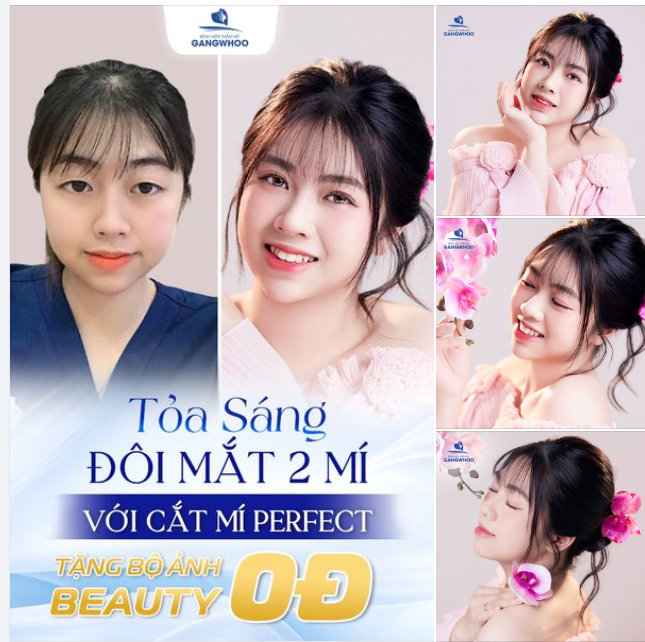 KHÁCH YÊU CẮT MÍ PERFECT CÙNG BỘ ẢNH BEAUTY TẠI GANGWHOO