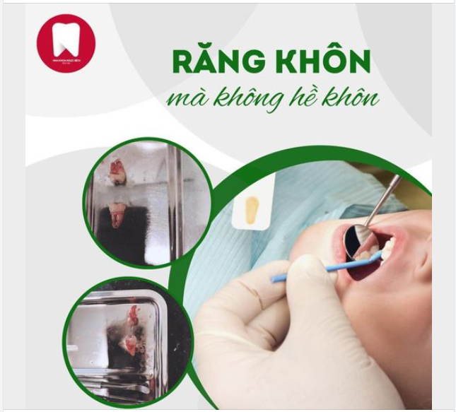 RĂNG KHÔN MÀ LẠI KHÔNG HỀ KHÔN