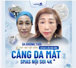 CĂNG DA MẶT SMAS NỘI SOI 4K LÀN DA KHÔNG TUỔI 