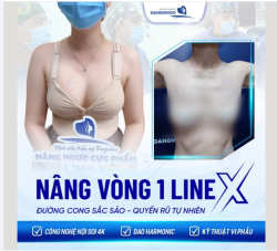 NÂNG VÒNG 1 LINEX - ĐƯỜNG CONG SẮC SẢO, QUYẾN RŨ TỰ NHIÊN