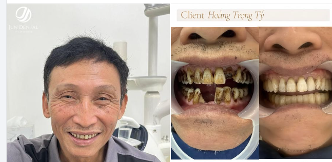 TOẢ SÁNG NỤ CƯỜI TỰ TIN