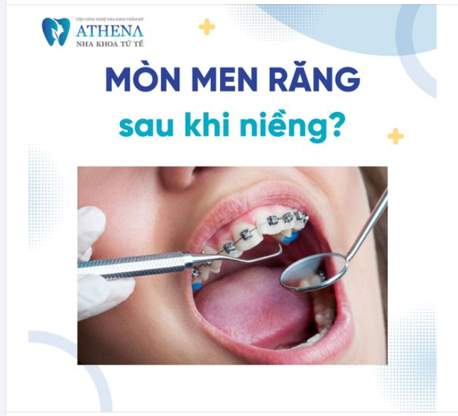 Niềng răng có làm răng yếu đi? Liệu có gây mòn men răng?