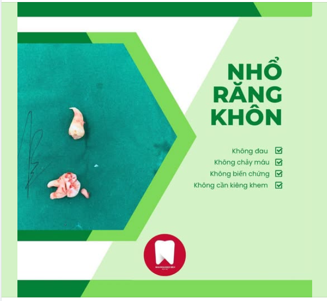 XOÁ TAN NỖI SỢ NHỔ RĂNG KHÔN