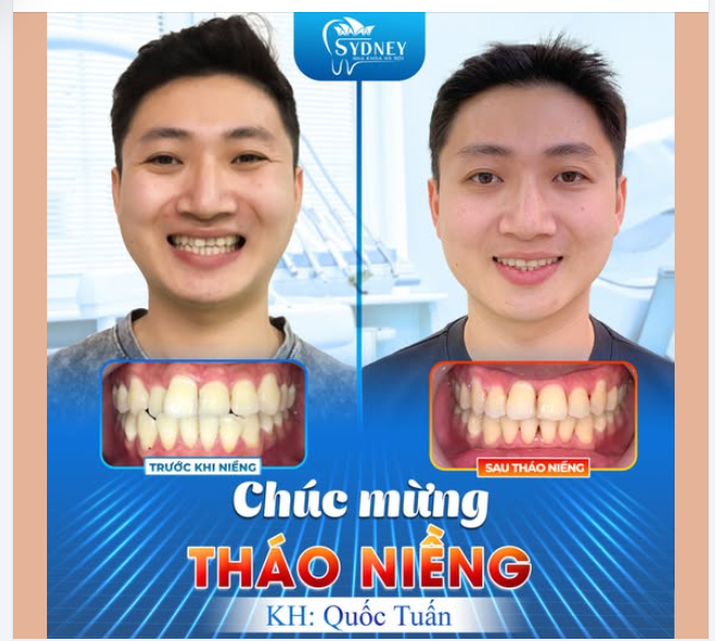 CHÚC MỪNG THÁO NIỀNG KH. QUỐC TUẤN