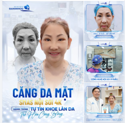 CĂNG DA MẶT SMAS NỘI SOI 4K HÀNH TRÌNH CHO LÀN DA CĂNG BÓNG