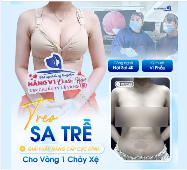 TREO SA TRỄ - GIẢI PHÁP NÂNG CẤP CỰC ĐỈNH CHO VÒNG 1 CHẢY XỆ!