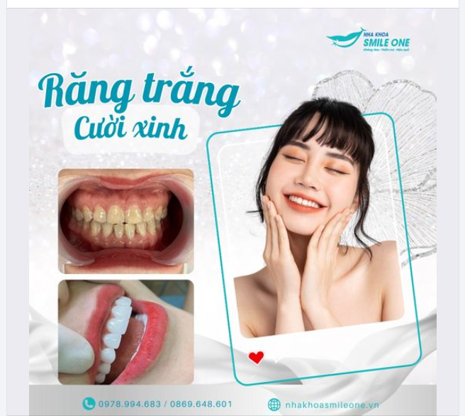 BỊ NÓI "KHÔNG SẠCH SẼ" CHỈ VÌ HÀM RĂNG Ố VÀNG!