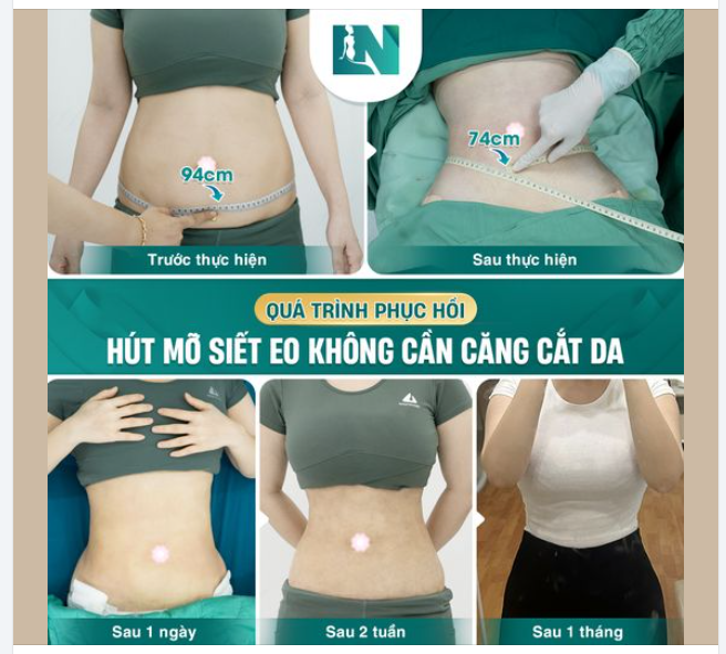 HÀNH TRÌNH HOÀN THIỆN VÓC DÁNG TRONG 1 THÁNG