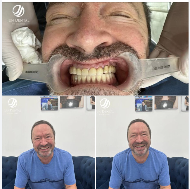 TÂN TRANG NỤ CƯỜI CHO VỊ KHÁCH ĐẶC BIỆT