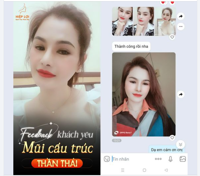 Feedback khách yêu sau "Nâng mũi cấu trúc" tại Hiệp Lợi