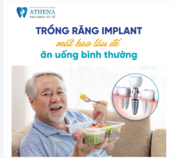 Trồng răng implant bao lâu thì ăn uống được?