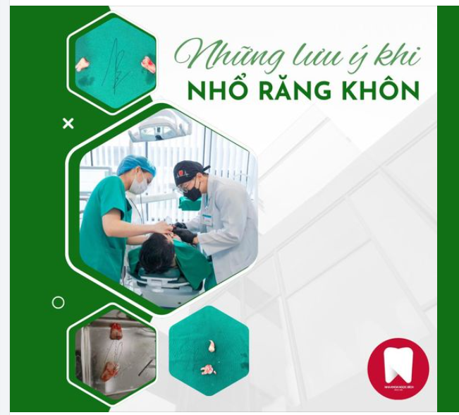 NẾU BẠN SẮP NHỔ RĂNG KHÔN, ĐỪNG BỎ QUA 5 LƯU Ý QUAN TRỌNG SAU