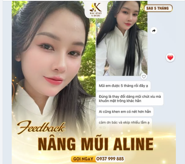 THAY ĐỔI NHAN SẮC SAU NÂNG MŨI ALINE